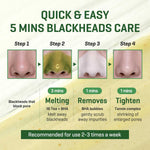 Some By Mi Bye Bye Blackhead 30 days Miracle Green Tea Tox Bubble Cleanser 120 ml – Ansicht 5